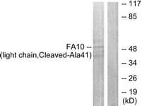F10 / Factor X Antibody (aa22-71)