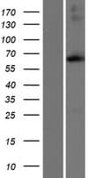 ACSM4 Protein (Over-Expression Lysate Myc-DDK (Flag))