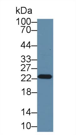 GSTP1 / GST Pi Antibody (aa1-210, APC)