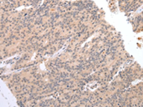 DEFB112 Antibody