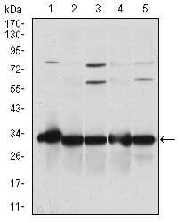NQO1 Antibody (clone 4D12)
