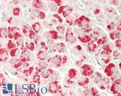 IHC-plus™ ASAP1 Antibody (clone 1B5)