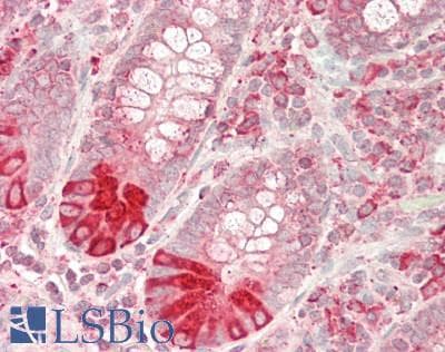 IHC-plus™ PDI / P4HB Antibody (aa29-313)