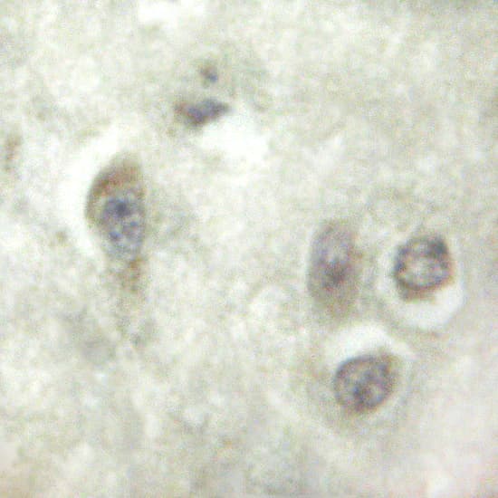Polyclonal Rabbit anti-Human HAK / ALPK2 Antibody (IHC, WB)