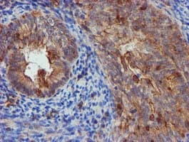 EPN2 Antibody (clone OTI1F5)