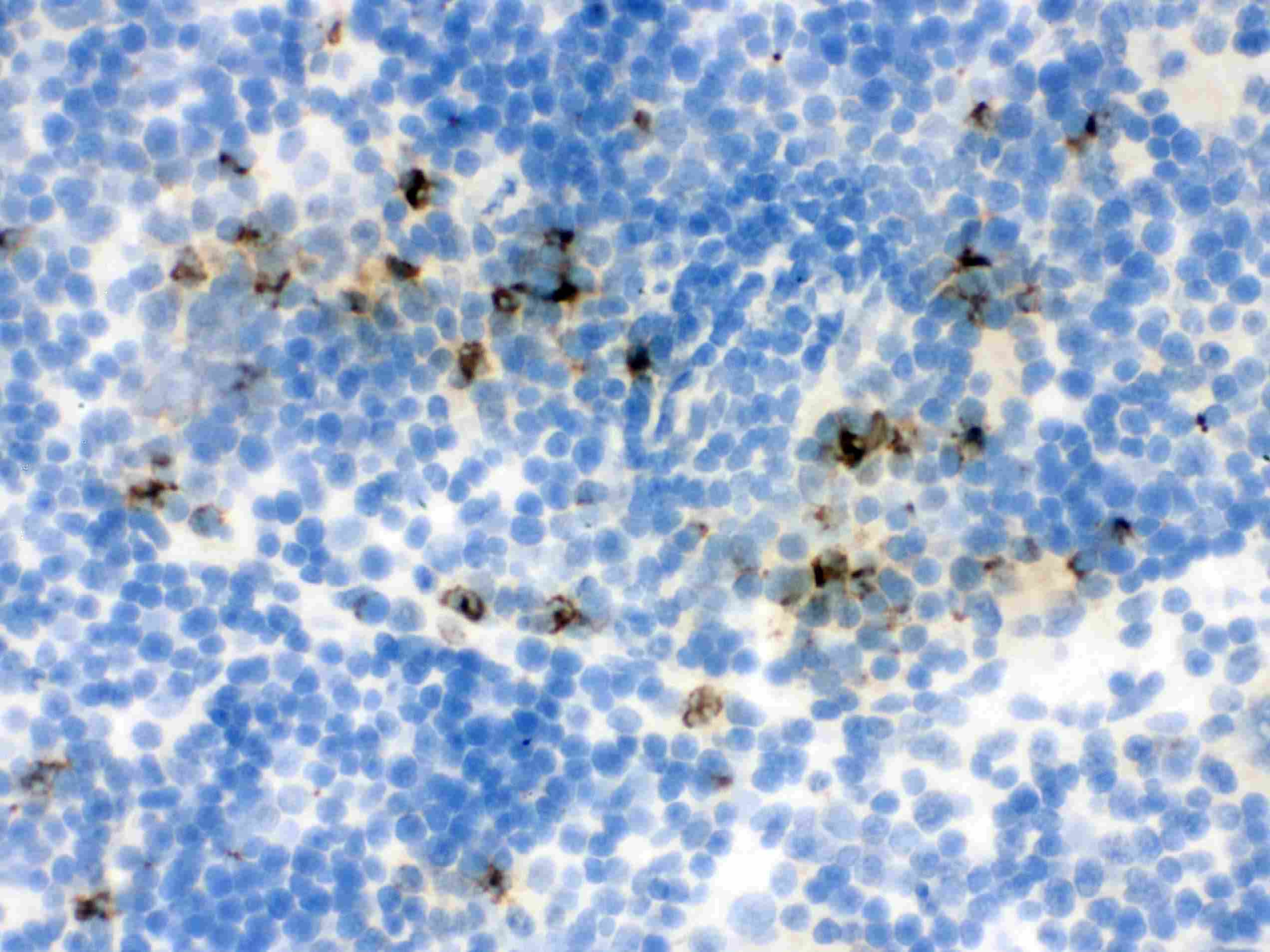 LCN2 / Lipocalin 2 / NGAL Antibody (aa21-200)