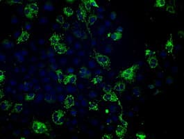 Monoclonal Mouse anti-Human FH / Fumarase / MCL Antibody (clone OTI2A2, IF, WB)