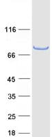 Human TRIM3 Protein (Recombinant Myc-DDK (Flag))