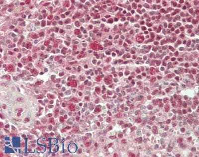 IHC-plus™ WDR5 Antibody (aa50-100)