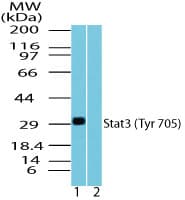 STAT3 Antibody (phospho-Tyr705)