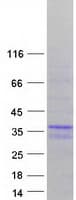 Human MBNL3 Protein (Recombinant Myc-DDK (Flag))