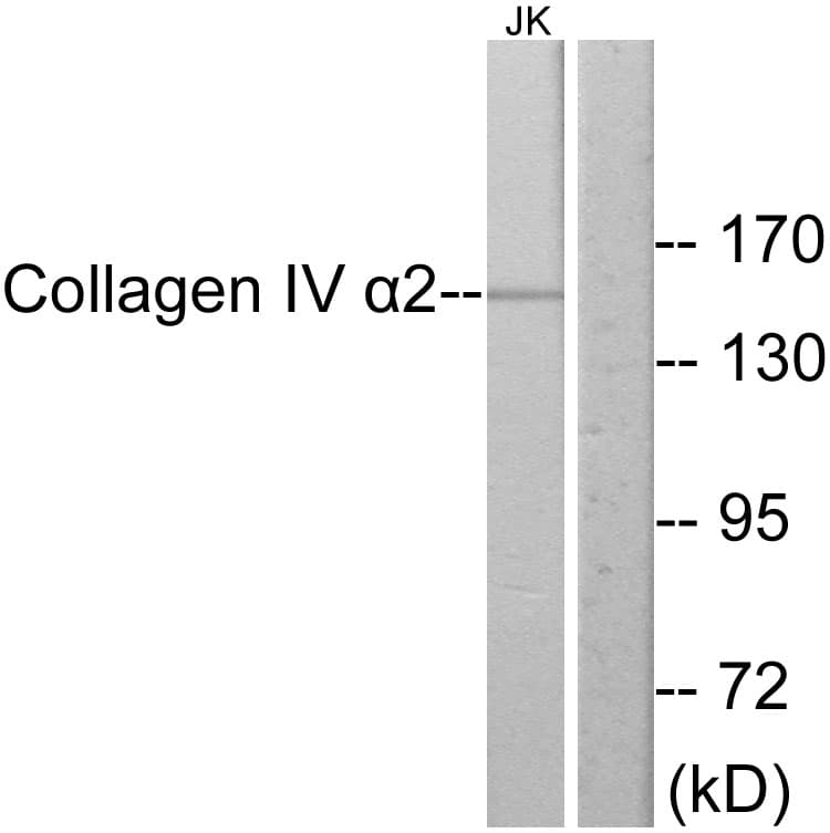 COL4A2 / Collagen IV Alpha2 Antibody (aa151-200)