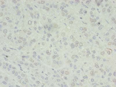 ZC3H7A Antibody