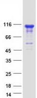 Human INPP4B Protein (Recombinant Myc-DDK (Flag))