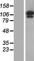 OGDH Protein (Over-Expression Lysate Myc-DDK (Flag))
