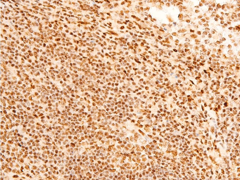 JUN / c-Jun Antibody (phospho-Ser243)
