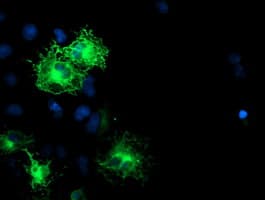SCHIP1 Antibody (clone OTI2A11)