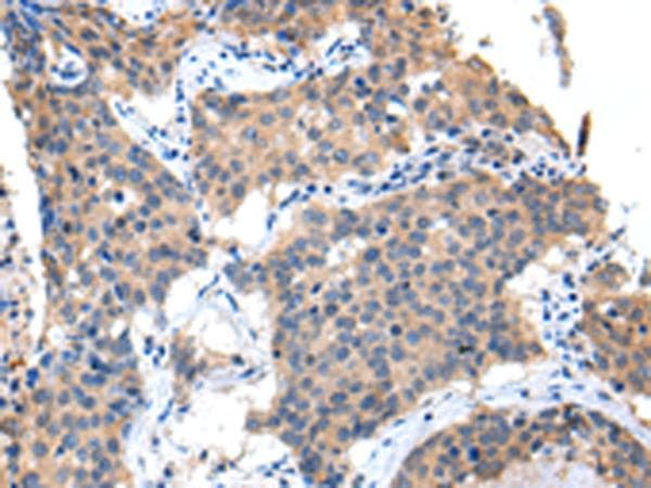 CXCL7 / PPBP Antibody