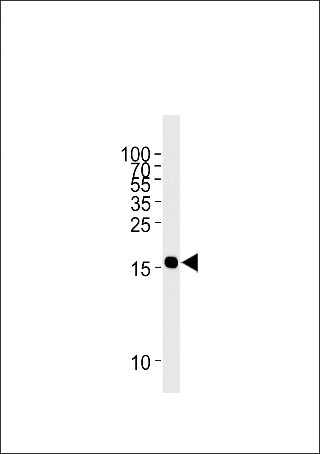 Monoclonal Mouse anti-Human GMFG Antibody (clone 789CT20.3.1.1, WB)