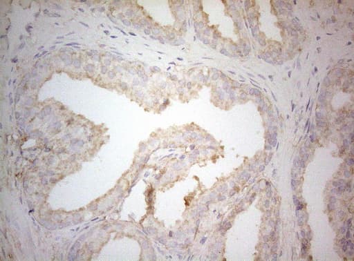 TWF1 / PTK9 Antibody (aa140-384, clone OTI5C12)