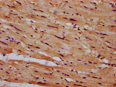 CSAD / CSD Antibody