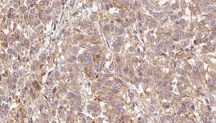 GPLD1 / GPIPLD Antibody