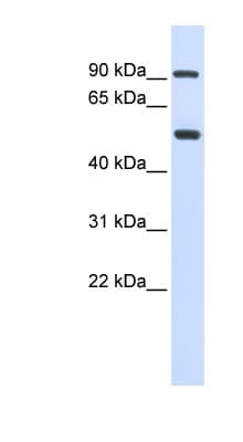 Polyclonal Rabbit anti-Human LOXL1 Antibody (aa360-409, WB)