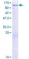 Human PLA2G6 / IPLA2 Protein (Recombinant GST)