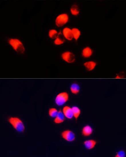 Polyclonal Rabbit anti-Human AIF1 / IBA1 Antibody (IHC, IF, WB)