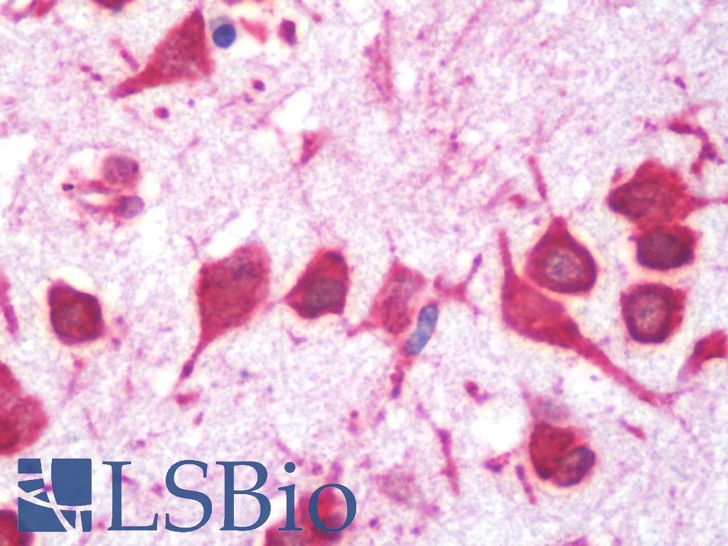IHC-plus™ CALCA Antibody (aa56-84, clone 406CT21.4.3)