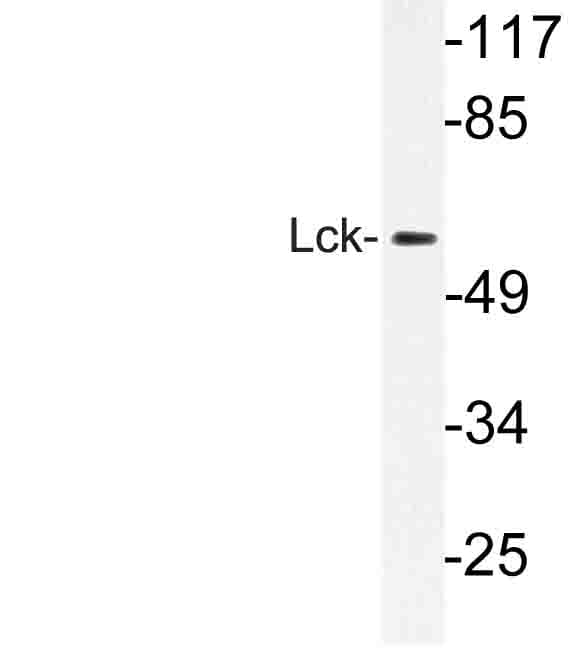 p56lck / LCK Antibody (Gly534)
