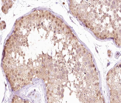 SENP1 Antibody