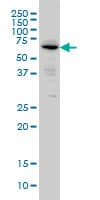 Monoclonal Mouse anti-Human ALPI / Alkaline Phosphatase Antibody (clone 3A8, WB)