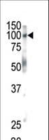EPHB1 / EPH Receptor B1 Antibody (aa955-984)