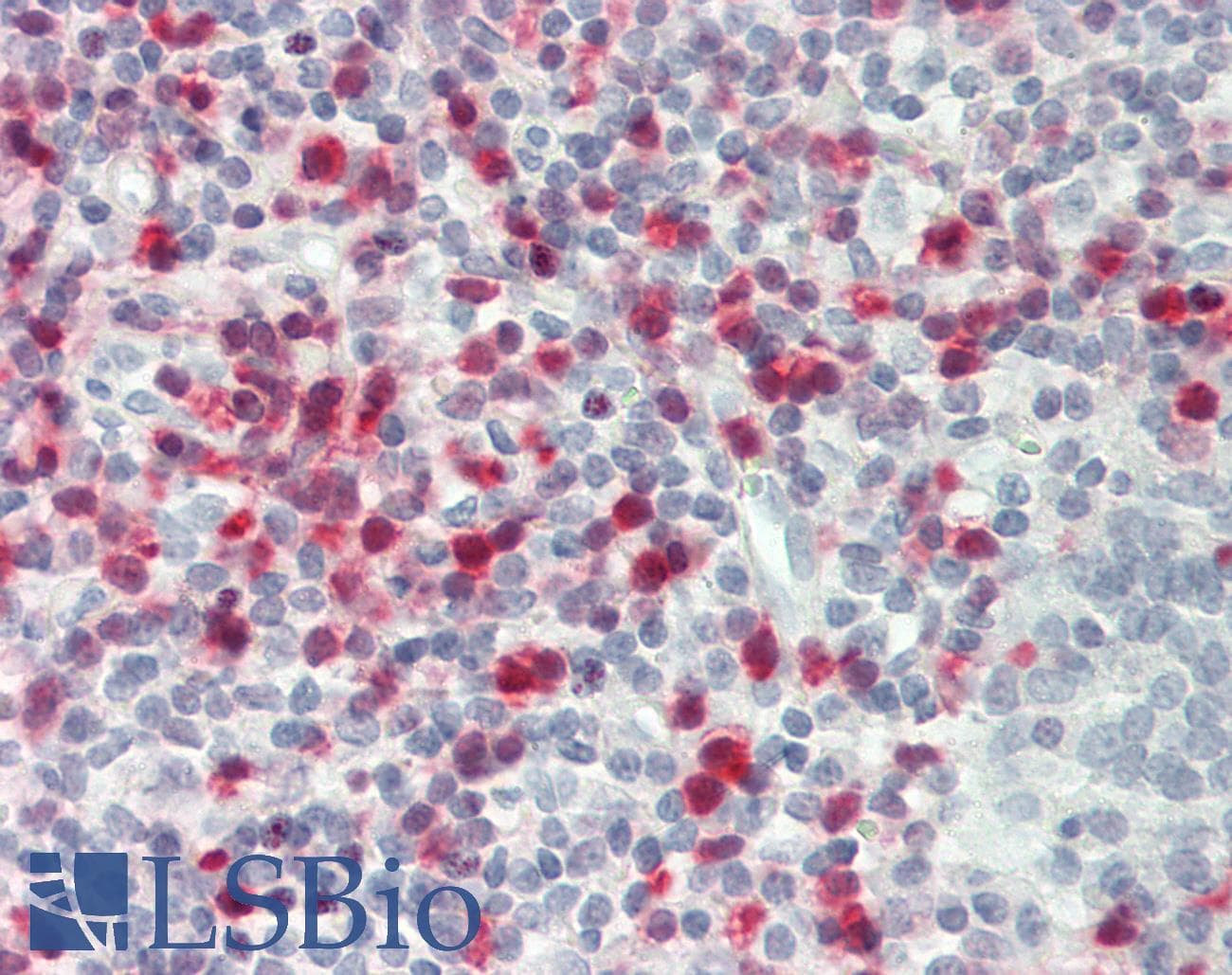 IHC-plus™ S100A4 / FSP1 Antibody (aa1-30)