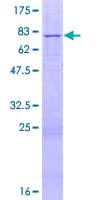 Human RSAD1 Protein (Recombinant GST)