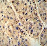 ALDP / ABCD1 Antibody (aa257-285)