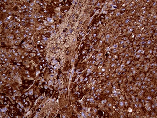 METTL7A Antibody (aa34-104, clone OTI4B10)