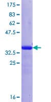 Human FSTL1 Protein (Recombinant GST, N-terminus)