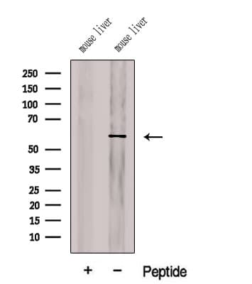 Polyclonal Rabbit anti-Human CHDH / CHD Antibody (IF, WB)
