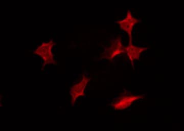 PR / Progesterone Receptor Antibody (phospho-Ser400)