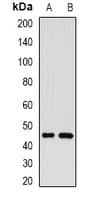 Polyclonal Rabbit anti-Human GOLM1 / GP73 / GOLPH2 Antibody (IHC, IF, WB)