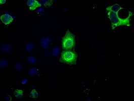 Basigin / Emmprin / CD147 Antibody (clone OTI4E4)