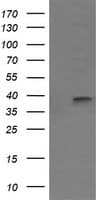 MAP2K3 / MEK3 / MKK3 Antibody (clone OTI2G8)