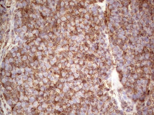 RET Antibody (aa713-1017, clone OTI21H5)