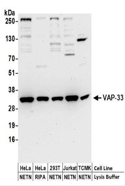 IHC-plus™ Polyclonal Rabbit anti-Human VAP33 / VAPA Antibody (aa125-175, IHC, WB)