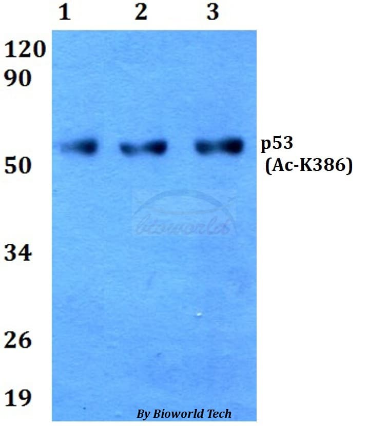 Polyclonal Rabbit anti-Human TP53 / p53 Antibody (Lys386, WB)