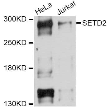 Polyclonal Rabbit anti-Human SETD2 Antibody (WB)