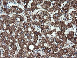 Monoclonal Mouse anti-Human ACAA2 Antibody (clone OTI2F6, IHC, IF, WB)