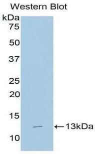 B2M / Beta 2 Microglobulin Antibody (aa22-119, FITC)